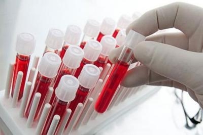 Biohemijska analiza krvi