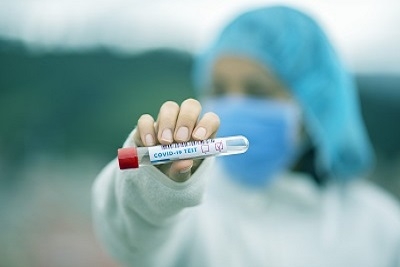 IgG antitela na Koronu, Spajk (Spike) protein – potvrda preležane bolesti ili uspešnosti vakcinacije