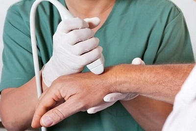 Kompletan pregled krvnih sudova ruku sa labaratorijom:Dopler krvnih sudova ruku,CRP i D-dimer