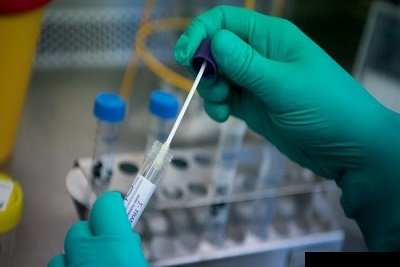 Korona virus brzi antigenski test na Vašoj adresi